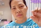 หมอ ยกเคส “สุนารี” หลังปวดท้องหนัก ต้องส่องกล้อง ตัดชิ้นเนื้อตรวจ
